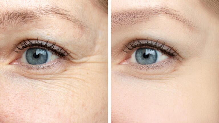 The Benefits of Oculoplastic Surgery: Restoring Your Confidence and Vision