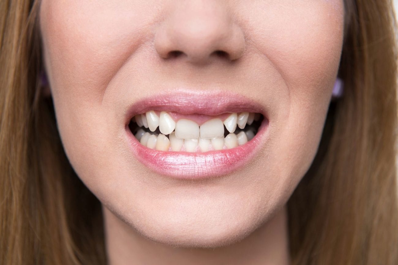 Straightening Crooked Teeth: Insights from a London Cosmetic Dentist